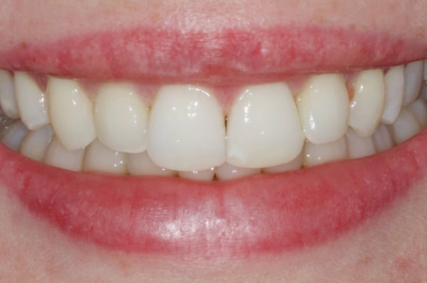 After -Auckland Cosmetic Dental Clinic