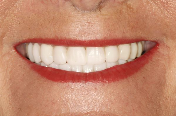 After -Auckland Cosmetic Dental Clinic