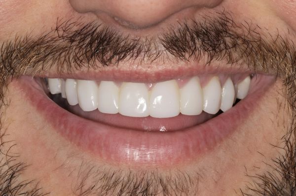 After -Auckland Cosmetic Dental Clinic