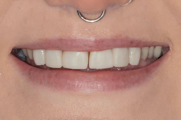 After -Auckland Cosmetic Dental Clinic