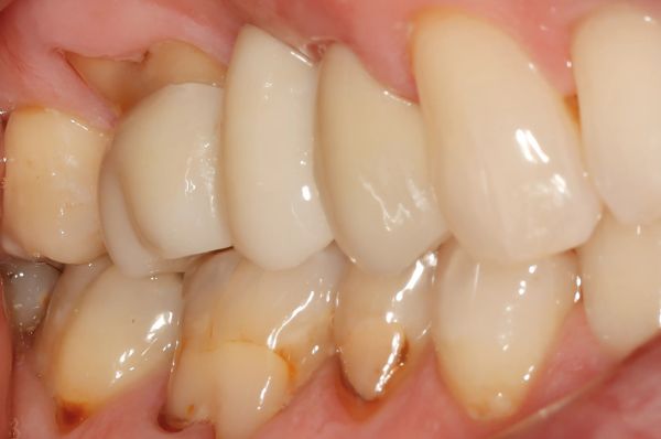 After -Auckland Cosmetic Dental Clinic