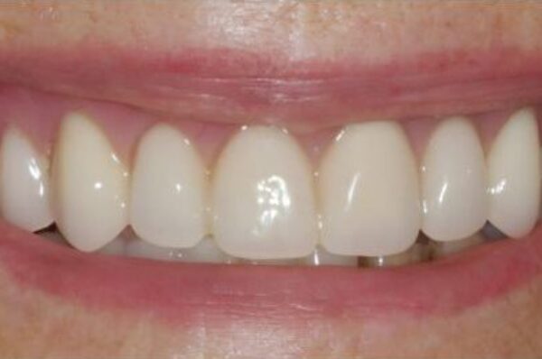 After -Auckland Cosmetic Dental Clinic
