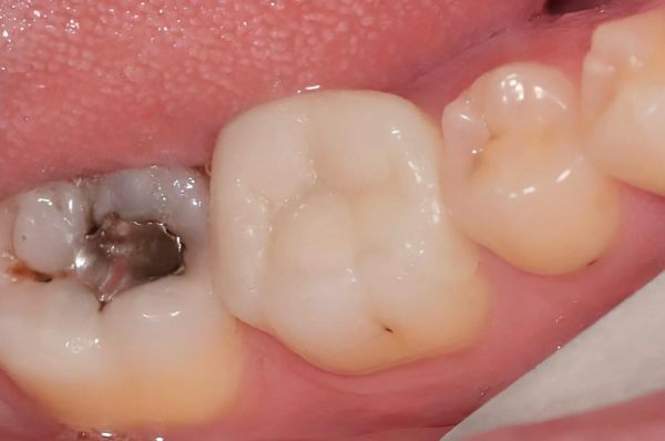 After -Auckland Cosmetic Dental Clinic